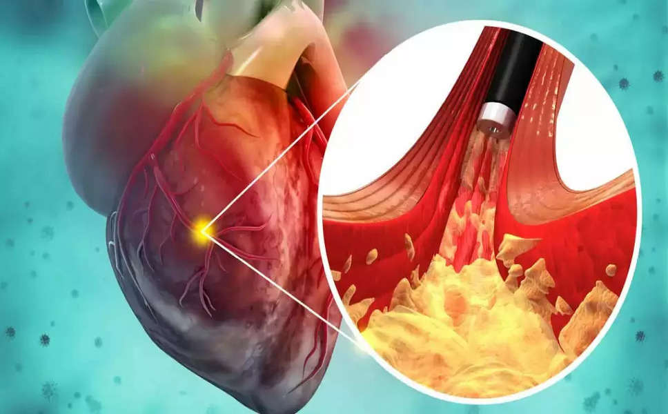 Heart Disease: दिल की दुश्मन हैं ये 4 चीजें, आज ही छोड़ें, वरना आएगा हार्ट अटैक